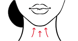 Neck Lift - Turkey Neck ThreadLift Toronto